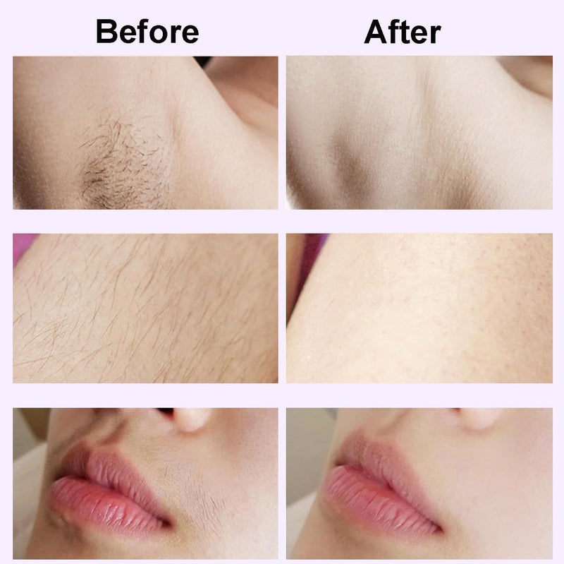 XYOUWEI 2 in 1 Bikini Trimmer for Women, Rechargeable Electric Razors for Women, Wet/Dry Use Lady Electric Shaver for Bikini Face Lip Underarm Legs Pubic Hair - Image 3
